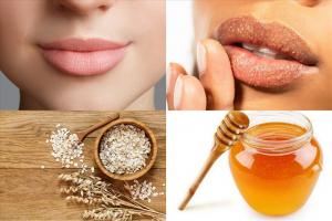 Bí quyết trị khô môi vào mùa đông hiệu quả nhât
