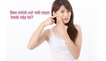 Bí quyết trị mụn tại nhà hiệu quả nhất