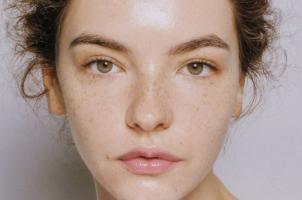 Loại serum trị tàn nhang hiệu quả nhất
