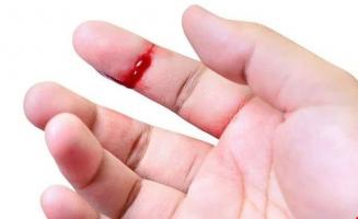 Xịt cầm máu, sát khuẩn vết thương hiệu quả nhất